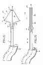 Fig. 08 - Removable lung reduction devices, systems, and methods