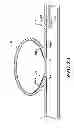 Fig. 05 - Endovascular closure device
