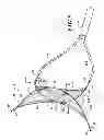 Fig. 07 - Endovascular closure device