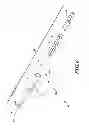 Fig. 10 - Endovascular closure device
