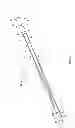 Fig. 02 - MULTI-LUMEN CENTRAL ACCESS VENA CAVA FILTER APPARATUS FOR CLOT MANAGEMENT AND METHOD OF USING SAME