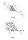 Fig. 13 - MULTI-LUMEN CENTRAL ACCESS VENA CAVA FILTER APPARATUS FOR CLOT MANAGEMENT AND METHOD OF USING SAME