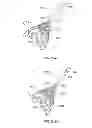 Fig. 14 - MULTI-LUMEN CENTRAL ACCESS VENA CAVA FILTER APPARATUS FOR CLOT MANAGEMENT AND METHOD OF USING SAME