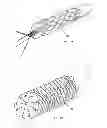 Fig. 20 - MULTI-LUMEN CENTRAL ACCESS VENA CAVA FILTER APPARATUS FOR CLOT MANAGEMENT AND METHOD OF USING SAME