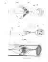 Fig. 22 - MULTI-LUMEN CENTRAL ACCESS VENA CAVA FILTER APPARATUS FOR CLOT MANAGEMENT AND METHOD OF USING SAME
