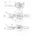 Fig. 25 - MULTI-LUMEN CENTRAL ACCESS VENA CAVA FILTER APPARATUS FOR CLOT MANAGEMENT AND METHOD OF USING SAME