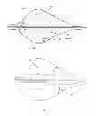 Fig. 28 - MULTI-LUMEN CENTRAL ACCESS VENA CAVA FILTER APPARATUS FOR CLOT MANAGEMENT AND METHOD OF USING SAME