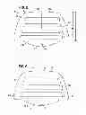 Fig. 05 - Nasal support device and method
