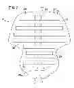 Fig. 06 - Nasal support device and method
