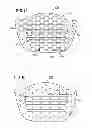 Fig. 09 - Nasal support device and method