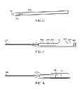 Fig. 03 - METHODS AND DEVICES FOR SUTURE ANCHOR DELIVERY