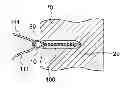 Fig. 01 - BIOLOGICAL SUTURE ANCHOR WITH SUTURE EYELET