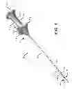 Fig. 02 - SUTURE ANCHOR INSERTION APPARATUS, SUTURE ANCHOR, AND METHODS OF USING THE SAME