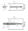 Fig. 12 - SUTURE ANCHOR INSERTION APPARATUS, SUTURE ANCHOR, AND METHODS OF USING THE SAME