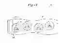 Fig. 03 - Medical Affixation Device