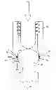 Fig. 07 - Spring clip bottom loading polyaxial ball and socket fastener