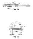 Fig. 04 - Bone plate assembly provided with screw locking mechanisms