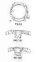 Fig. 09 - Bone plate assembly provided with screw locking mechanisms