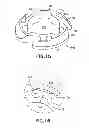Fig. 11 - Bone plate assembly provided with screw locking mechanisms