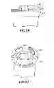 Fig. 17 - Bone plate assembly provided with screw locking mechanisms