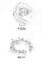 Fig. 19 - Bone plate assembly provided with screw locking mechanisms