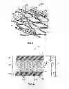 Fig. 02 - Radiopaque drug-filled prosthesis and method of making same