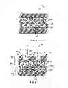 Fig. 04 - Radiopaque drug-filled prosthesis and method of making same
