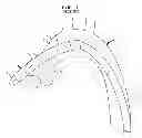 Fig. 02 - Apparatus and method for aortic protection and TAVI planar alignment