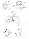 Fig. 06 - Apparatus and method for aortic protection and TAVI planar alignment