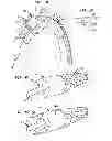 Fig. 07 - Apparatus and method for aortic protection and TAVI planar alignment