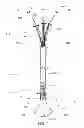 Fig. 02 - Medical device, kit and method for constricting tissue or a bodily orifice, for example, a mitral valve