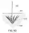Fig. 08 - Medical device, kit and method for constricting tissue or a bodily orifice, for example, a mitral valve
