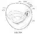 Fig. 35 - Medical device, kit and method for constricting tissue or a bodily orifice, for example, a mitral valve