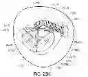 Fig. 45 - Medical device, kit and method for constricting tissue or a bodily orifice, for example, a mitral valve