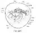 Fig. 49 - Medical device, kit and method for constricting tissue or a bodily orifice, for example, a mitral valve