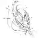 Fig. 01 - Methods of valve delivery on a beating heart