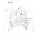 Fig. 02 - Methods of valve delivery on a beating heart
