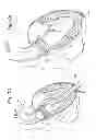 Fig. 06 - Methods of valve delivery on a beating heart