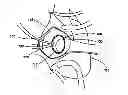 Fig. 01 - IMPLANTABLE DEVICES FOR CONTROLLING THE SIZE AND SHAPE OF AN ANATOMICAL STRUCTURE OR LUMEN