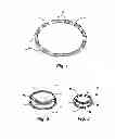 Fig. 02 - IMPLANTABLE DEVICES FOR CONTROLLING THE SIZE AND SHAPE OF AN ANATOMICAL STRUCTURE OR LUMEN