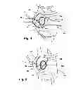 Fig. 03 - IMPLANTABLE DEVICES FOR CONTROLLING THE SIZE AND SHAPE OF AN ANATOMICAL STRUCTURE OR LUMEN