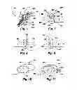 Fig. 04 - IMPLANTABLE DEVICES FOR CONTROLLING THE SIZE AND SHAPE OF AN ANATOMICAL STRUCTURE OR LUMEN