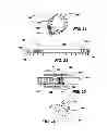 Fig. 09 - IMPLANTABLE DEVICES FOR CONTROLLING THE SIZE AND SHAPE OF AN ANATOMICAL STRUCTURE OR LUMEN