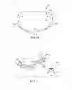 Fig. 20 - IMPLANTABLE DEVICES FOR CONTROLLING THE SIZE AND SHAPE OF AN ANATOMICAL STRUCTURE OR LUMEN