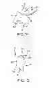 Fig. 07 - Arthroplasty system and related methods