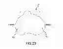 Fig. 45 - Arthroplasty system and related methods