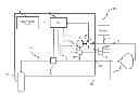 Fig. 01 - Methods And Apparatus To Zero A Patient Trigger Sensor
