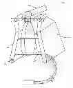 Fig. 01 - Apparatus, System and Method of Remotely Actuating a Manual Ventilation Bag