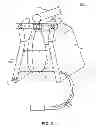 Fig. 04 - Apparatus, System and Method of Remotely Actuating a Manual Ventilation Bag