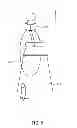 Fig. 06 - Apparatus, System and Method of Remotely Actuating a Manual Ventilation Bag